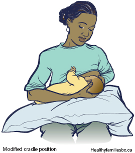 2.Modified Cradle position for Breastfeeding.jpg