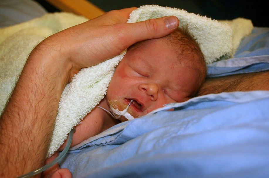 Newborn baby with gastric tube in mouth, asleep on father's chest
